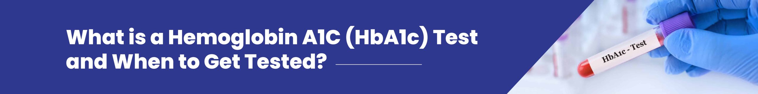 What is a Hemoglobin A1C (HbA1C) Test