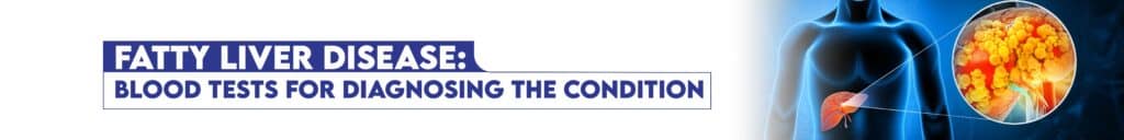 Fatty Liver Disease: Blood Tests for Diagnosing