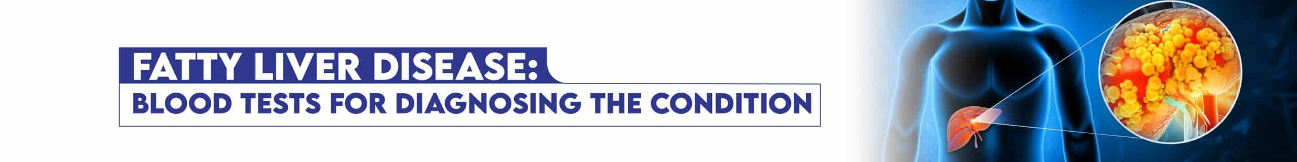 Fatty Liver Disease: Blood Tests for Diagnosing