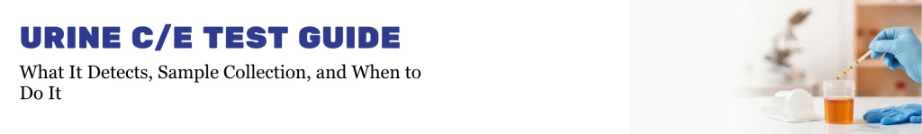 A professional laboratory photograph showing a hand wearing a blue nitrile glove dipping a reagent test strip into a clear plastic cup containing a yellow urine sample. Next to the cup on a white counter are a packaged empty sample container, two glass slides, and another folded glove. The background is a softly blurred laboratory setting with shelves and equipment under warm light, and a large, clean white gradient space is on the left.