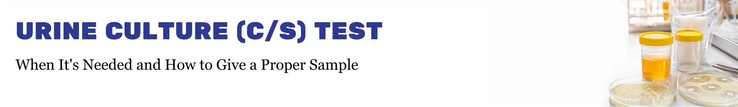 Urine Culture C/S Test guide showing sterile urine sample containers and petri dishes in a laboratory